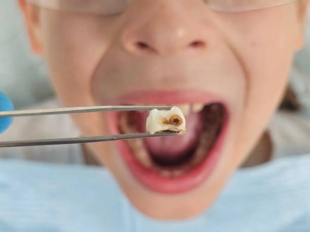 Best After-Hours Emergency Dentist in Kellogg, ID